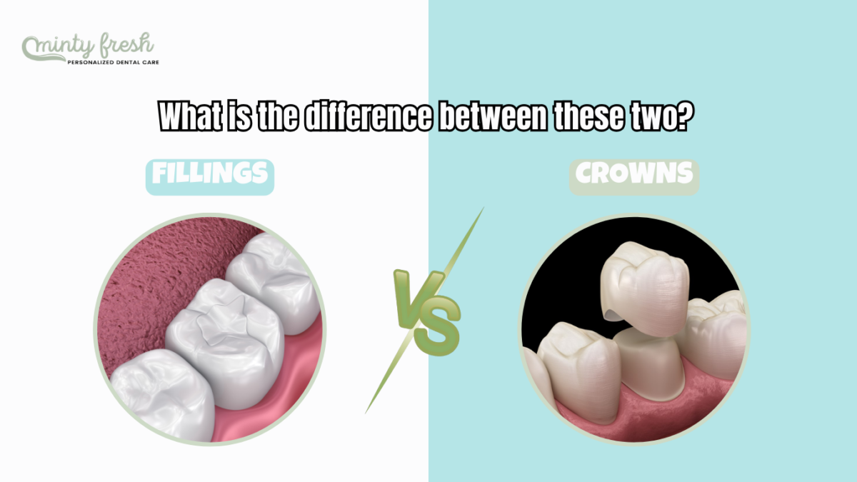 Difference between Fillings and Crowns Coral Gables, FL
