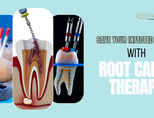 Root Canal – Coral Gables, Florida