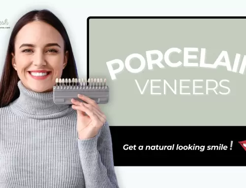 Porcelain Veneers – Coral Gables, Florida