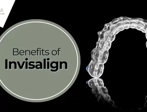 Transform Your Smile with Invisalign: Comprehensive Care at Minty Fresh Miami