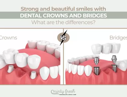 Dental Crowns and Bridges in Coral Gables, FL