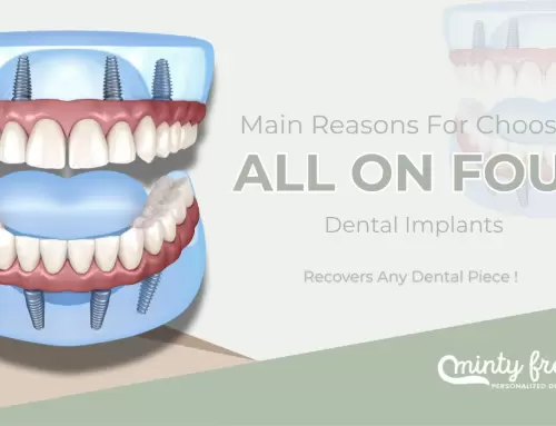 Main Reasons For Choosing ALL-ON-FOUR Dental Implants in Coral Gables, FL