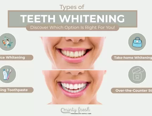 Types of Teeth Whitening in Coral Gables, FL