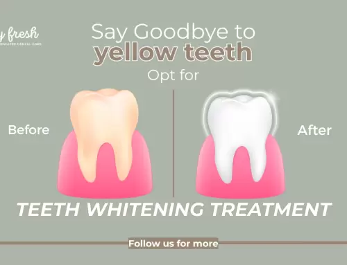 Our Teeth Whitening Options in Coral Gables, FL